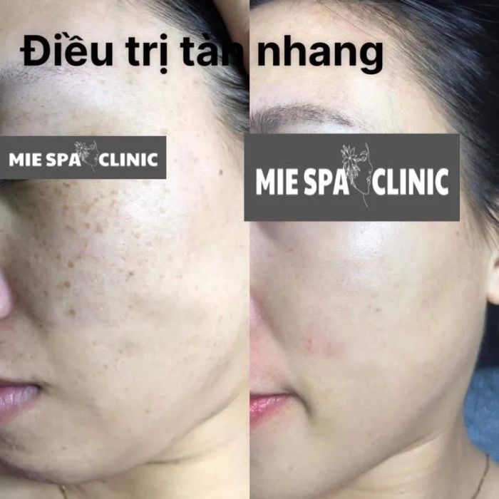 Mie Spa & Clinic (Ảnh 1)