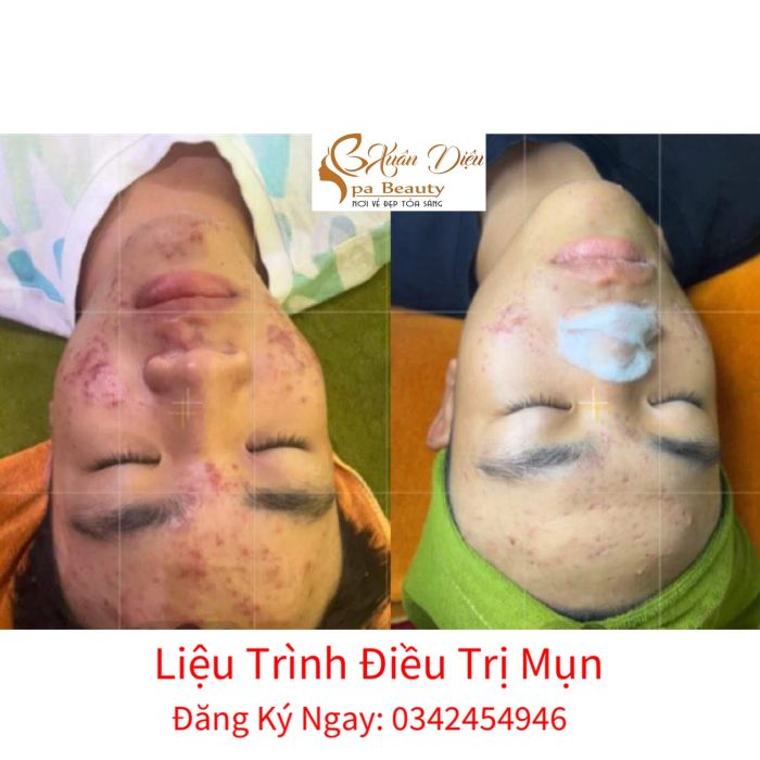Xuân Diêu Spa Beauty ảnh 1