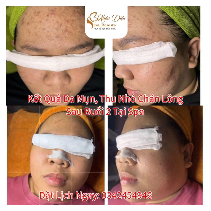 Xuân Diêu Spa Beauty ảnh 2