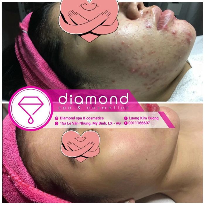 Diamond Spa & Cosmetics ảnh 1