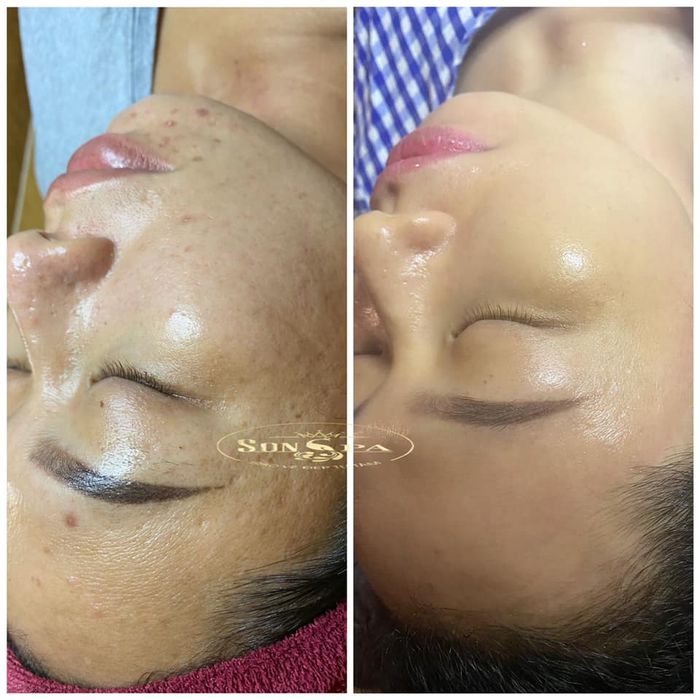 Hình ảnh liệu trình chăm sóc da tại Son Spa