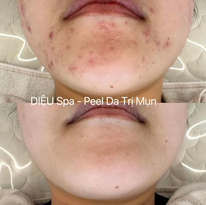 Diệu Spa Long Xuyên ảnh 1