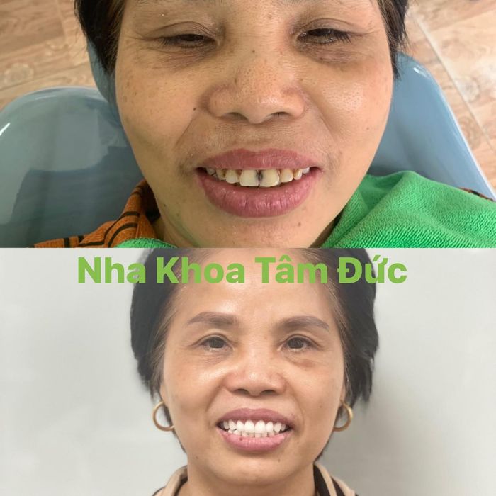 Ảnh Nha Khoa Tâm Đức 2