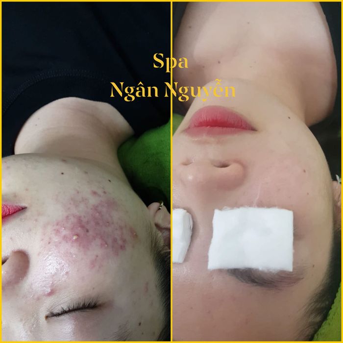 Hình ảnh không gian điều trị tại Spa Ngân Nguyễn