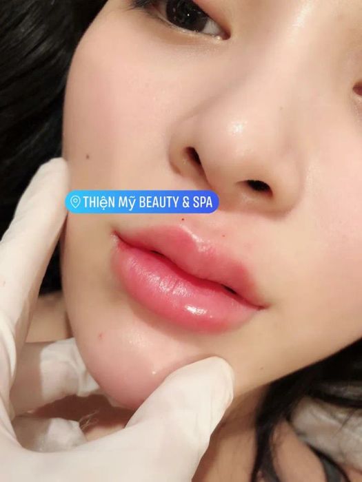 Thiện Mỹ Beauty Spa hình ảnh 2