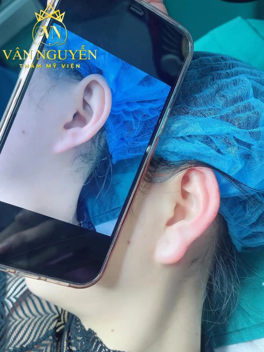 Viện Thẩm Mỹ Vân Nguyễn hình ảnh 2