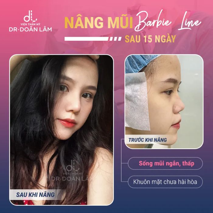 Hình ảnh Đại lý Gạo Thanh Mai tại Bỉm Sơn