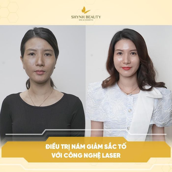 Hình ảnh Shynh Beauty Spa 1