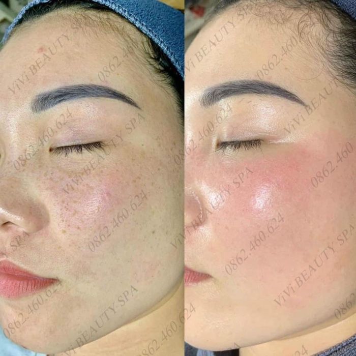 Hình ảnh ViVi Beauty & Spa 1