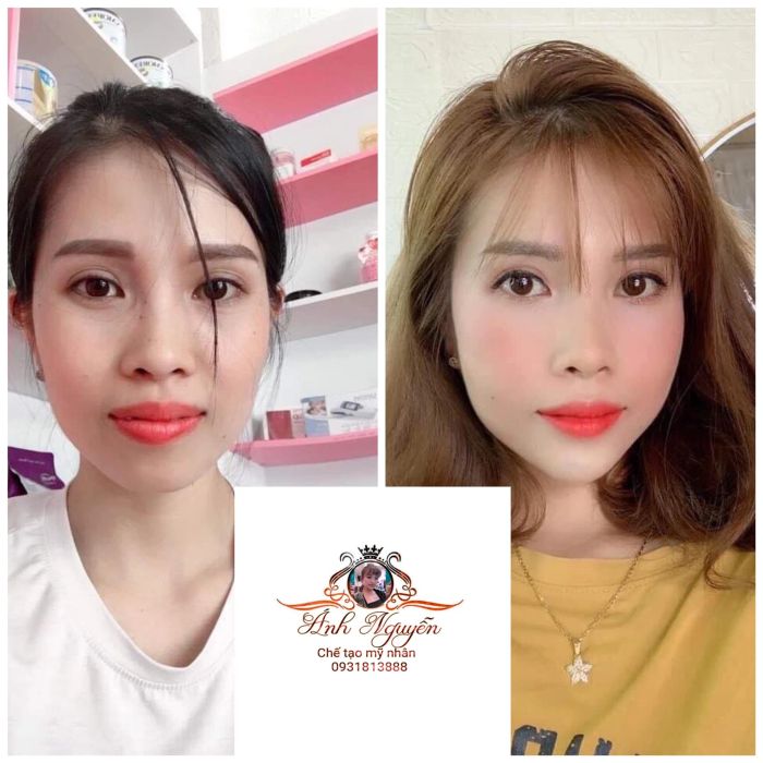 Viện Thẩm Mỹ Ánh Nguyễn hình ảnh 1