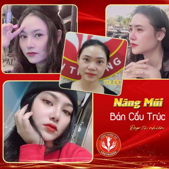 Viện Thẩm mỹ Văn Trường - Hình ảnh 1