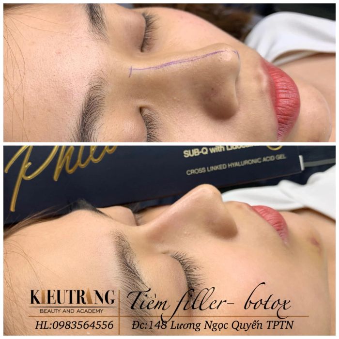 Viện Thẩm Mỹ HaNa hình ảnh 1