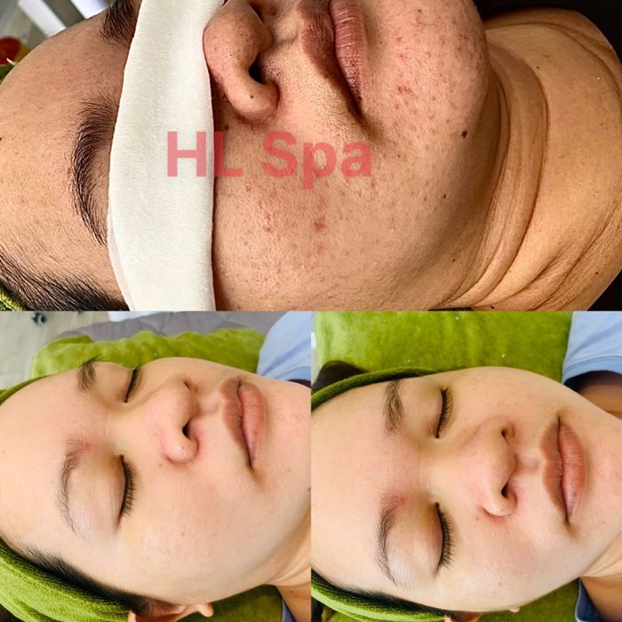 Hình ảnh HL Spa & Beauty 1