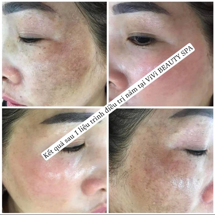 Hình ảnh ViVi Beauty & Spa 2