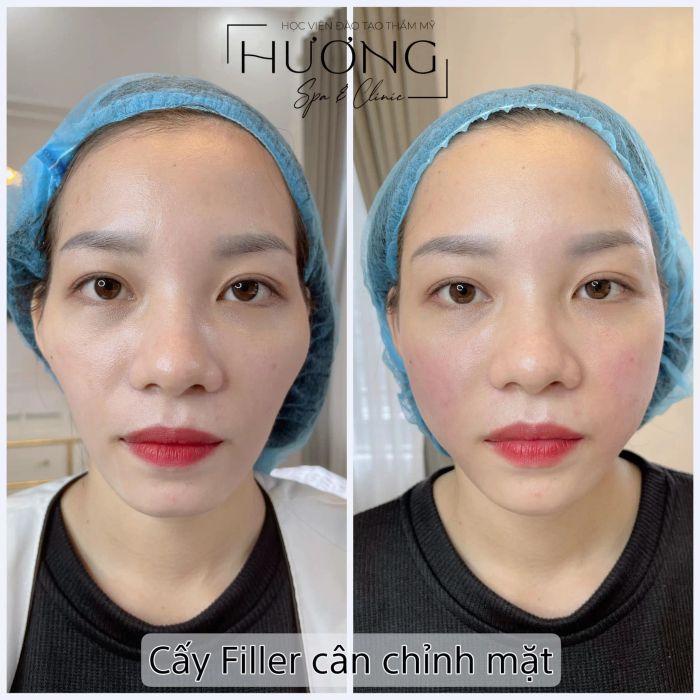 HƯƠNG Spa & Clinic hình ảnh 2