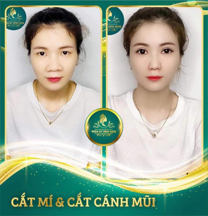Thẩm Mỹ Hồng Hạnh Đà Nẵng - Hình ảnh 1
