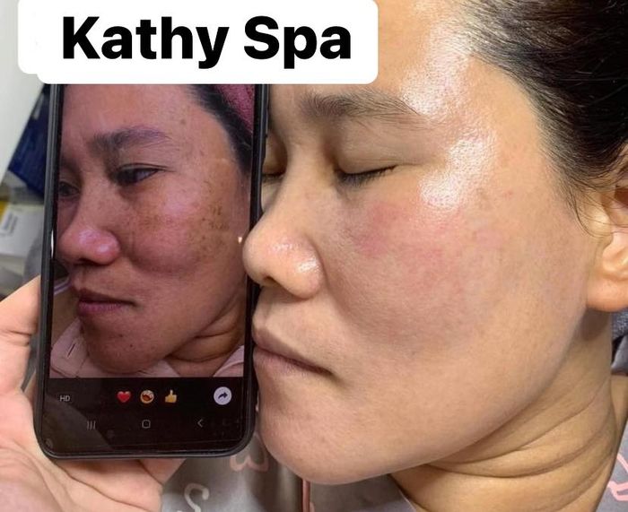 Hình ảnh Spa & Beauty Kathy 1