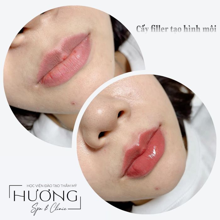 HƯƠNG Spa & Clinic hình ảnh 1