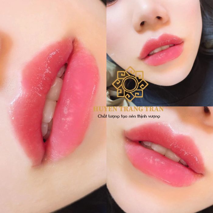 Huyen Trang Tran Beauty Center hình ảnh 1