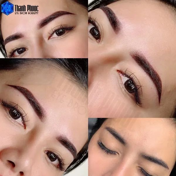 Bộ sưu tập hình ảnh khách hàng trước và sau khi sử dụng dịch vụ tại Thanh Phuoc Beauty