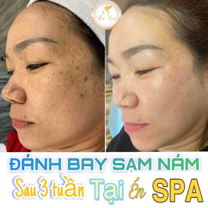 Hình ảnh Én Beauty Clinic 1