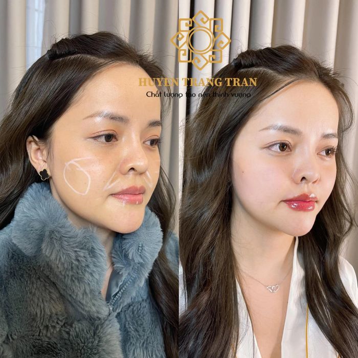 Huyen Trang Tran Beauty Center hình ảnh 2