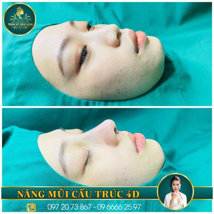 Thẩm Mỹ Hồng Hạnh Đà Nẵng - Hình ảnh 2