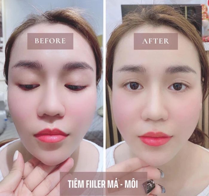 Viện Thẩm Mỹ Vân Nguyễn hình ảnh 1