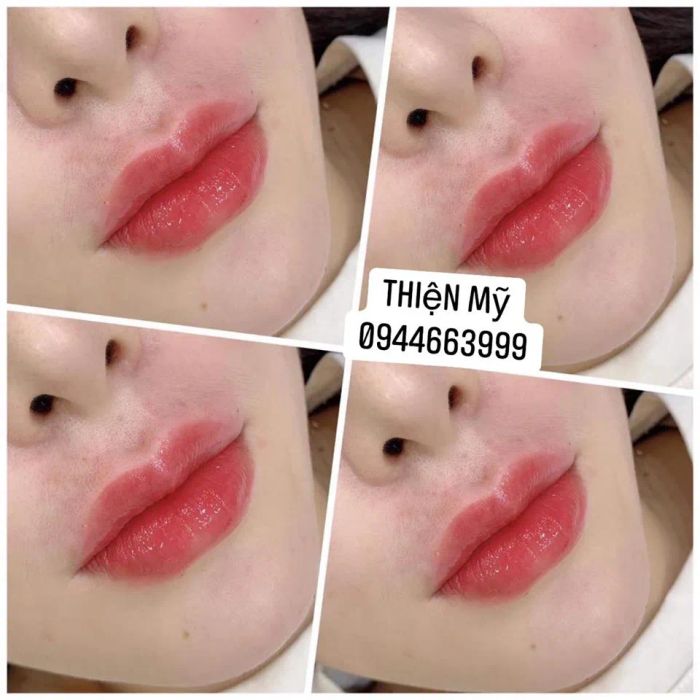 Thiện Mỹ Beauty Spa hình ảnh 1