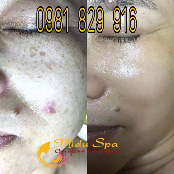 Hình ảnh Midu Spa 1