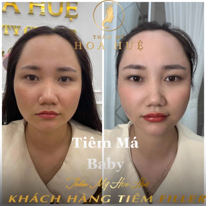 Thẩm Mỹ Quốc Tế Hoa Huệ hình ảnh 2