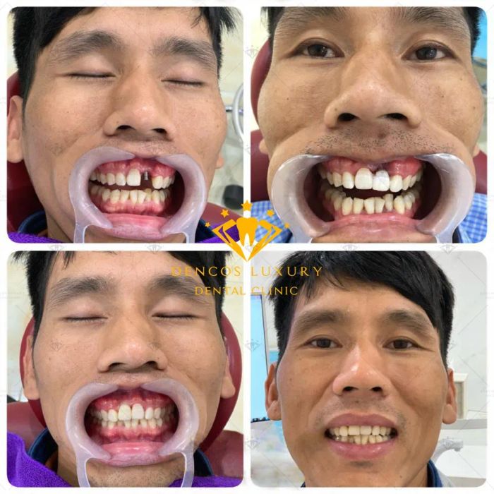 Dencos Luxury - Viện nha khoa thẩm mỹ Thanh Hóa ảnh 1