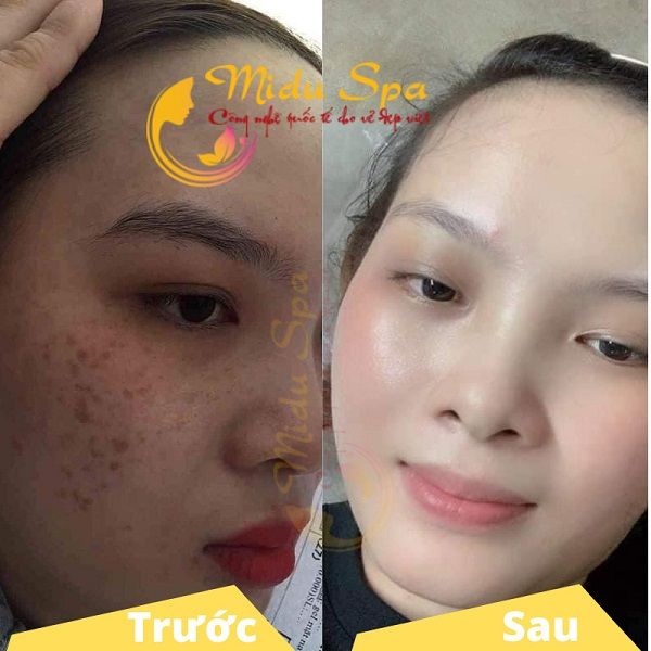 Hình ảnh Midu Spa 2