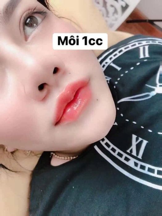Viện Thẩm Mỹ HaNa hình ảnh 2