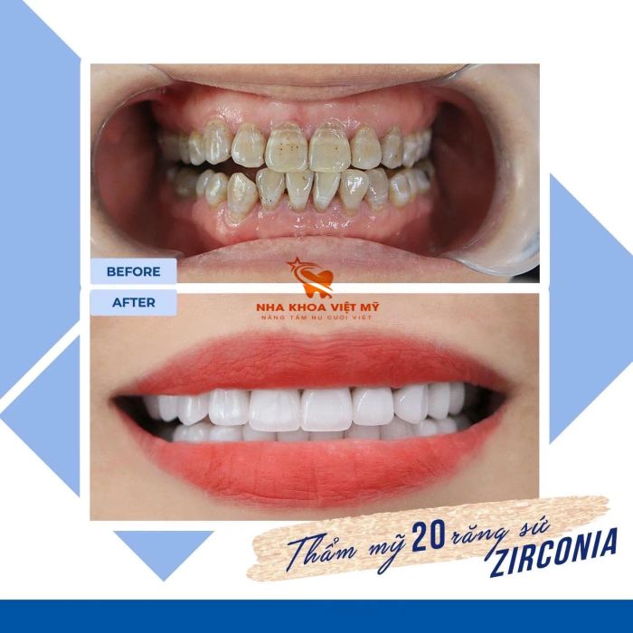 Hình ảnh đội ngũ bác sĩ tận tâm tại Nha Khoa Việt Mỹ