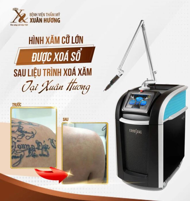 Hình ảnh khách hàng hài lòng sau khi xóa xăm tại Xuân Hương