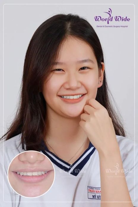 Bệnh viện thẩm mỹ - Răng hàm mặt WorldWide ảnh 2