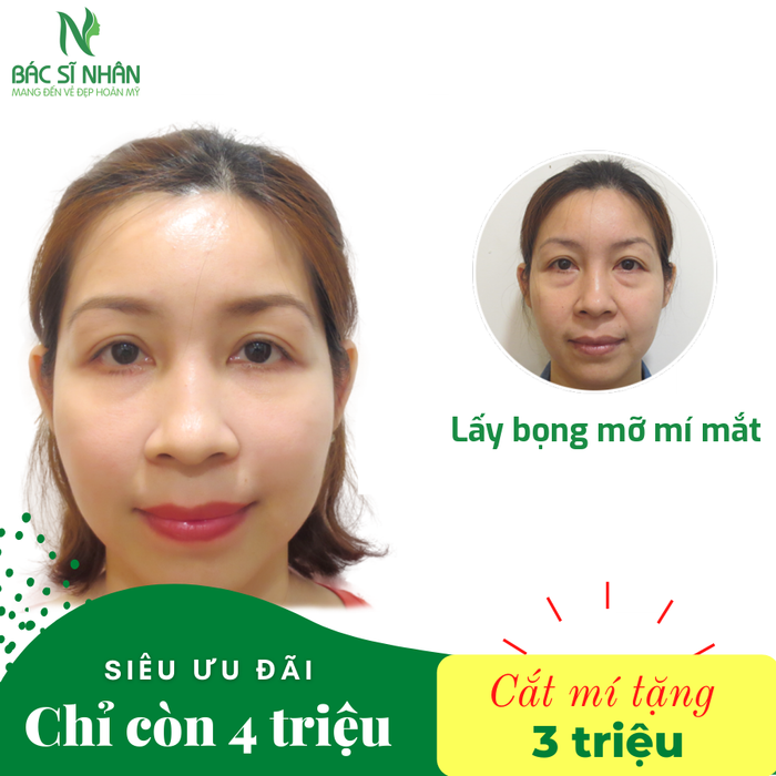 Hình ảnh Thẩm Mỹ Viện BS Nhân