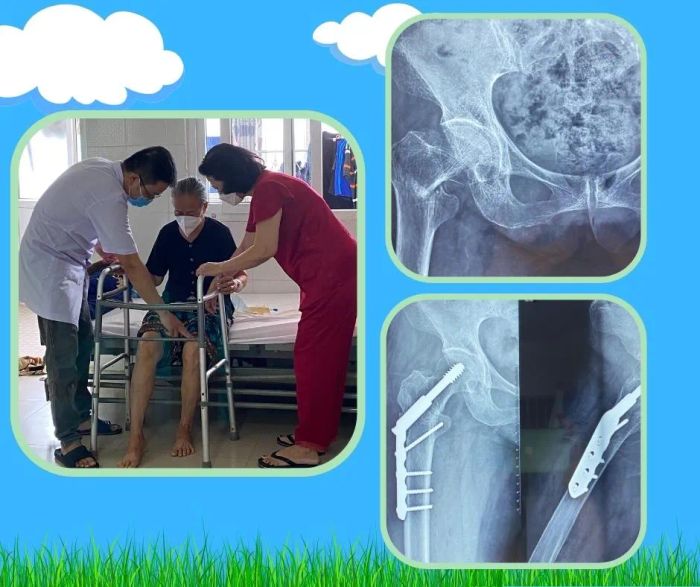 Hình ảnh khu vực điều trị tại Bệnh viện Chỉnh hình và Phục hồi chức năng Đà Nẵng