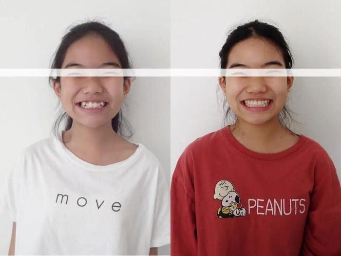 Hình ảnh 2: Trải nghiệm dịch vụ cao cấp tại KLAVA Smart Dental với hệ thống phòng khám đạt chuẩn quốc tế