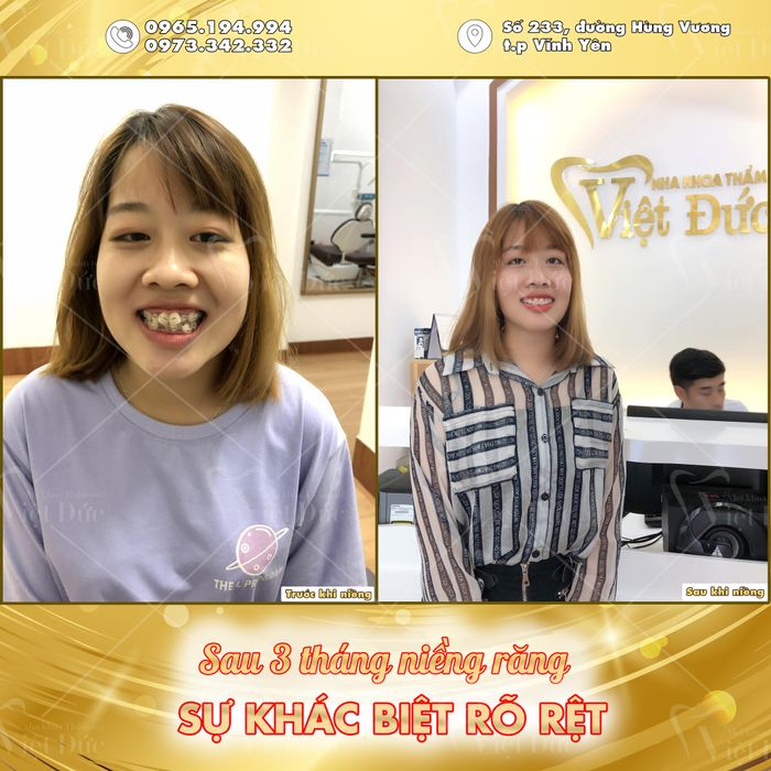 Nha Khoa Thẩm Mỹ Việt Đức ảnh 2