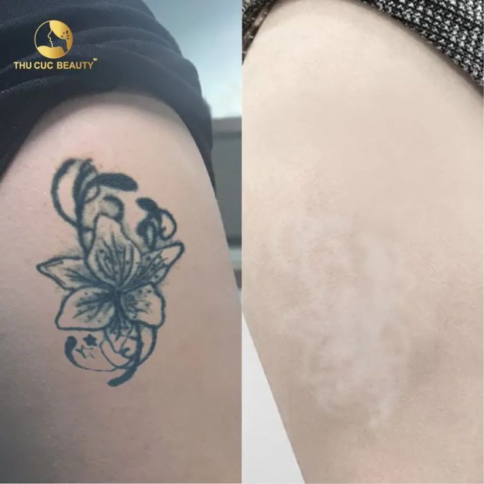 Hình ảnh Thẩm Mỹ Thu Cúc Sài Gòn