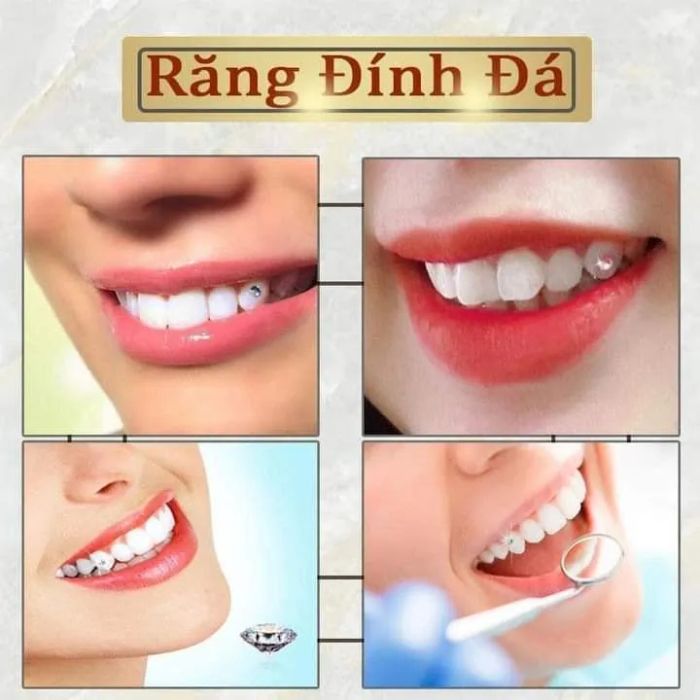 Hình ảnh đội ngũ bác sĩ chuyên môn cao tại Nha Khoa Bạch Mai