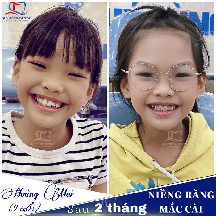 Nha Khoa Quý Tùng Thái Nguyên ảnh 1