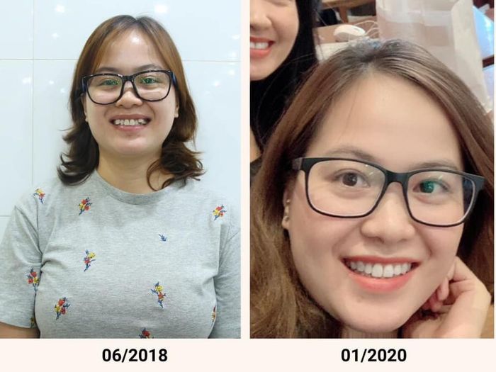 Hình ảnh Nha Khoa Link - Không gian hiện đại, sang trọng