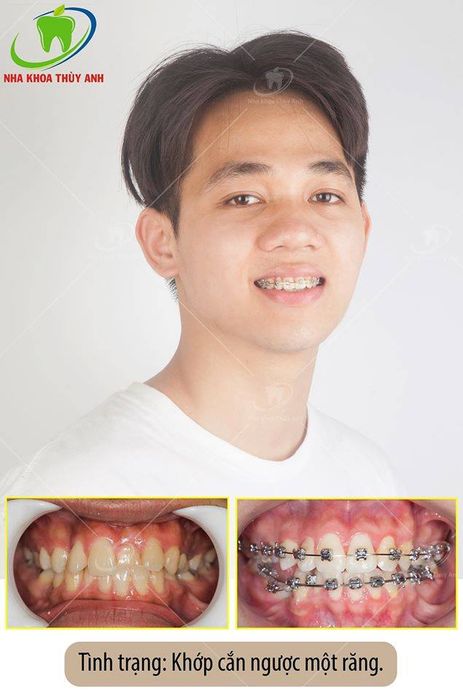 Nha Khoa Thùy Anh ảnh 1