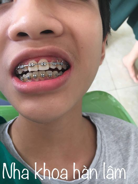 Nha Khoa Hàn Lâm Thái Nguyên ảnh 1