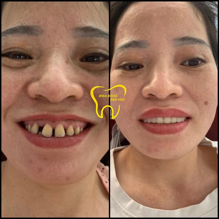 Hình ảnh thực tế tại Nha Khoa Thu Cúc