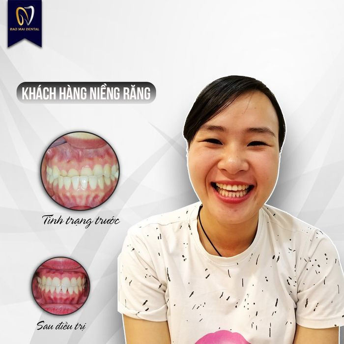 Nha Khoa Bảo Mai ảnh 2