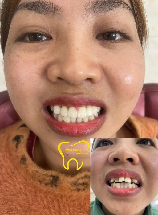Hình ảnh Nha Khoa Thu Cúc
